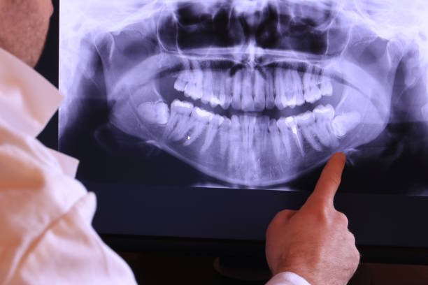 Trusted TX Emergency Dental Service Experts